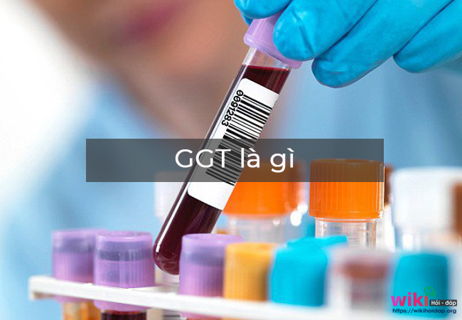GGT là gì? Xét nghiệm chỉ số GGT đánh giá men gan 